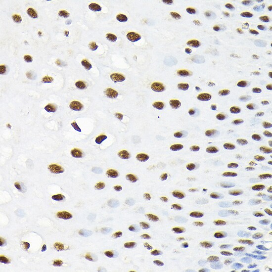 KPNA3 Antibody