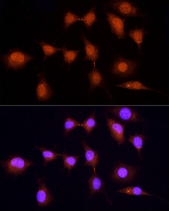 KPNA3 Antibody