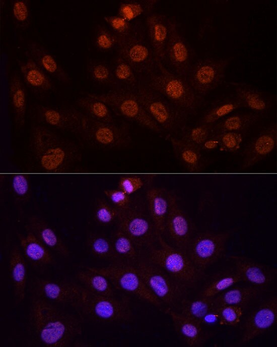 KPNA3 Antibody