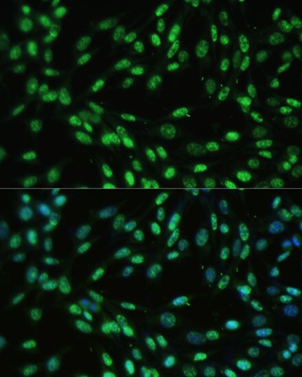 UAP56 Antibody