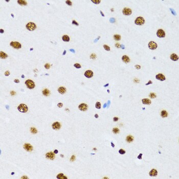 UAP56 Antibody