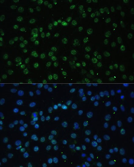 UAP56 Antibody