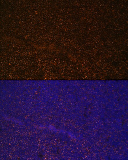 CD21 Antibody