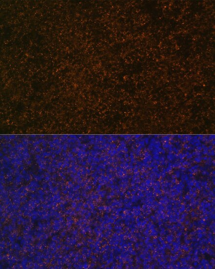 CD21 Antibody