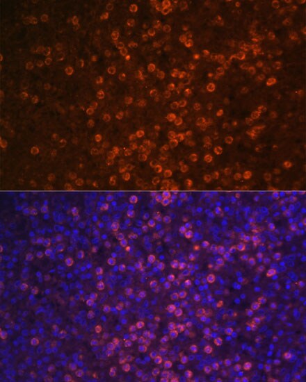 CD21 Antibody