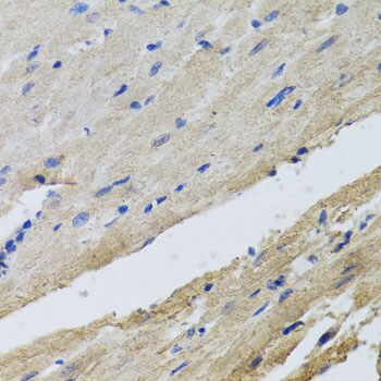 FECH Antibody