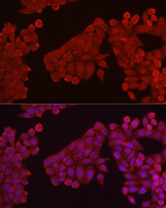 Hexokinase Type III Antibody
