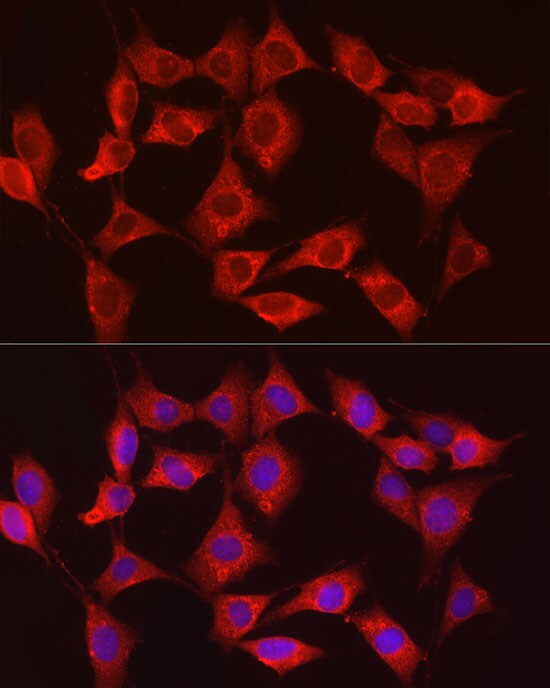 Hexokinase Type III Antibody