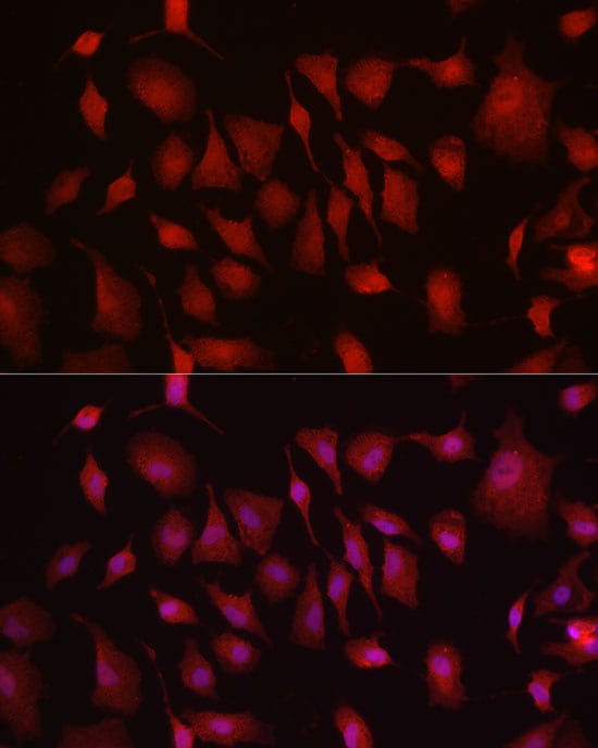 Hexokinase Type III Antibody