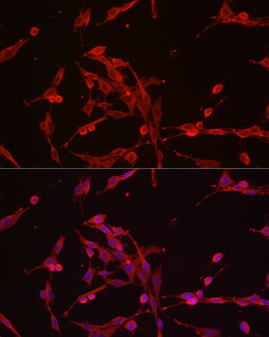 Hexokinase Type III Antibody