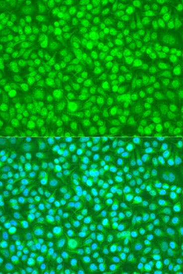 N4BP1 Antibody