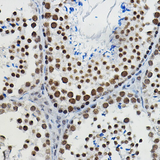 METTL14 Antibody