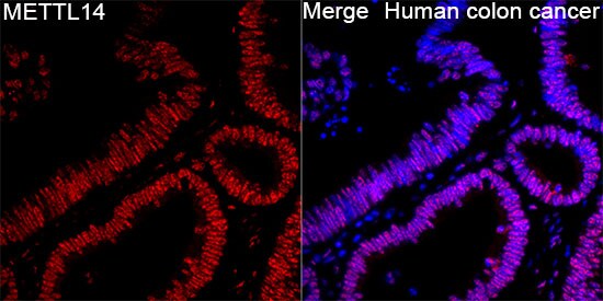 METTL14 Antibody