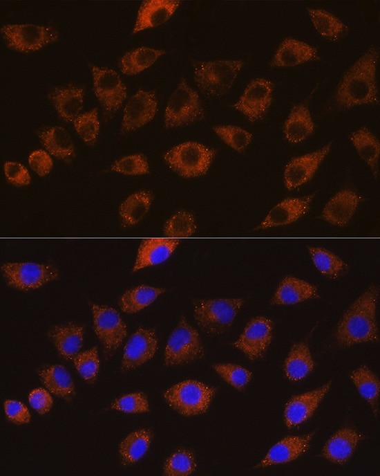 DLG1 Antibody