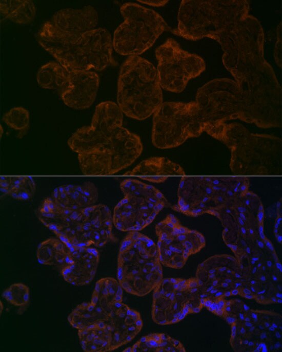 Myosin VB Antibody