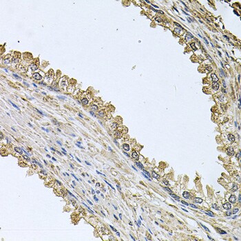 mediator of cell motility 1 Antibody