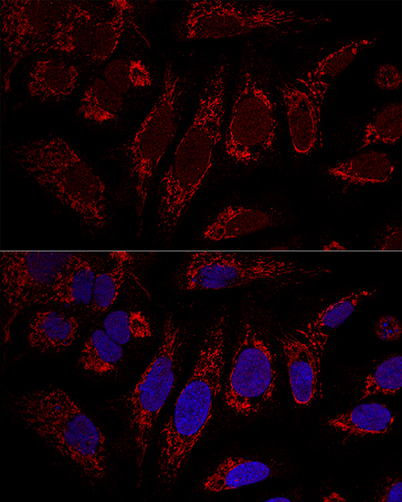 CHCHD3 Antibody