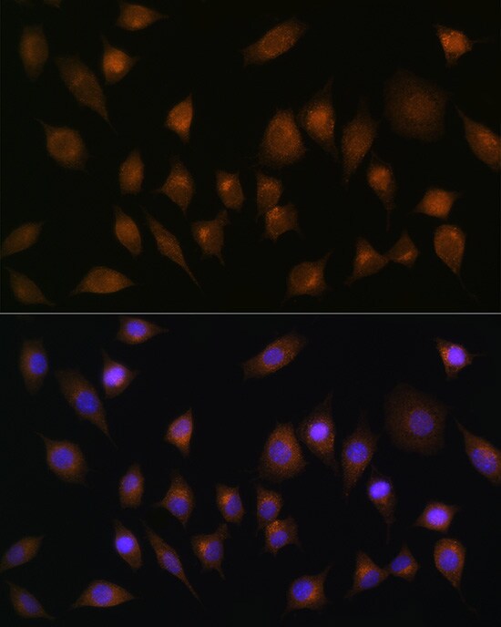 SNX1 Antibody