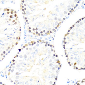 DDX50 Antibody