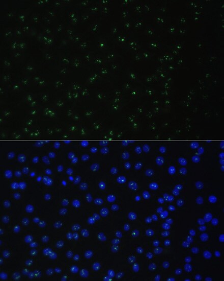 DDX50 Antibody