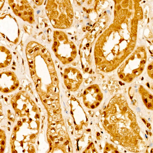 ALDH7A1 Antibody