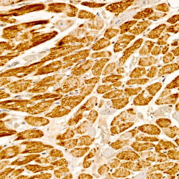 ALDH7A1 Antibody