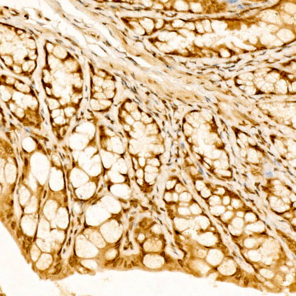ALDH7A1 Antibody