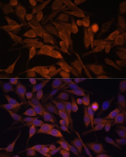 CACYBP Antibody