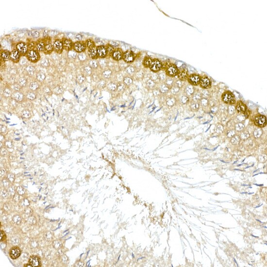 HDGFRP3 Antibody