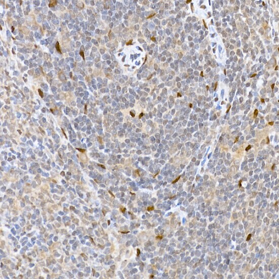HDGFRP3 Antibody