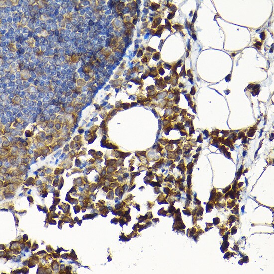 SCFD1 Antibody
