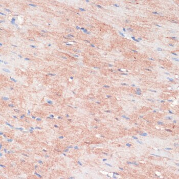RPIA Antibody