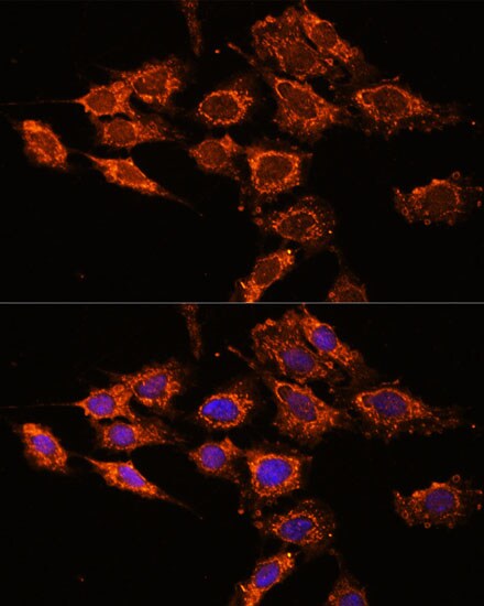 PASK Antibody