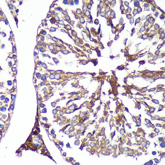 PASK Antibody