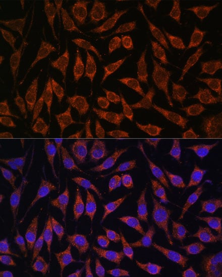 PASK Antibody