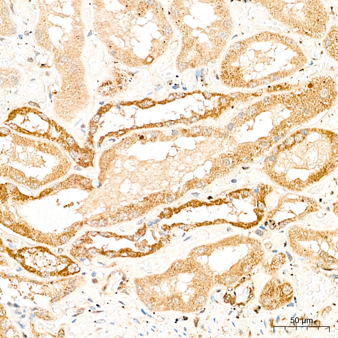 GCDH Antibody