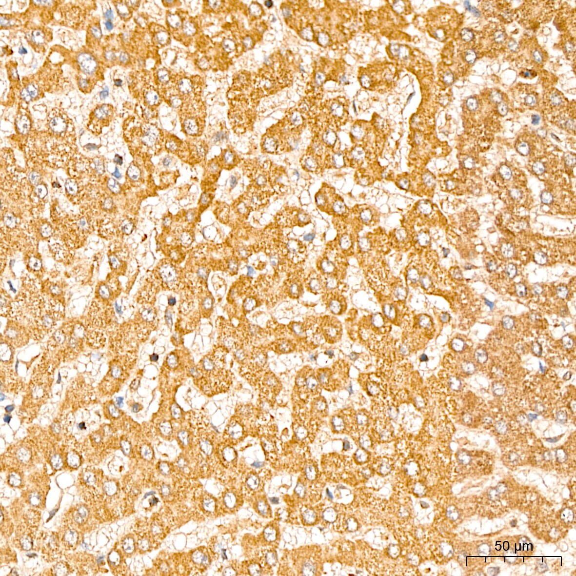 GCDH Antibody