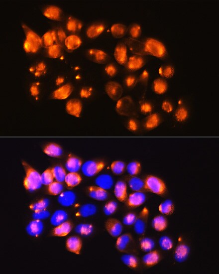 EPB4IL2 Antibody