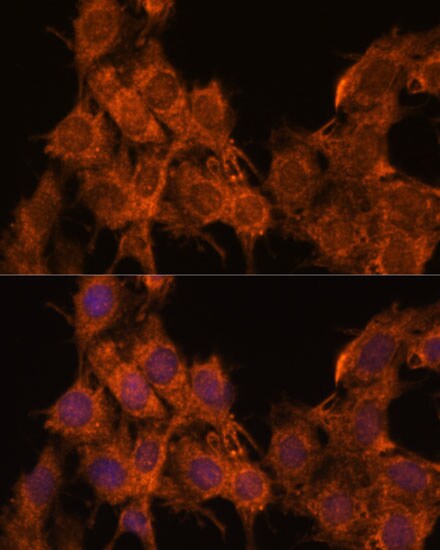SNX15 Antibody