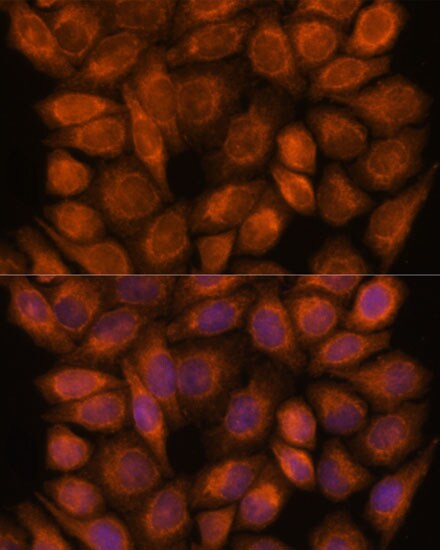 SNX15 Antibody