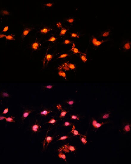 GTF3C4 Antibody