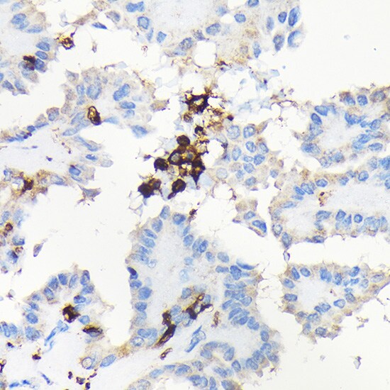 Coronin-1a Antibody