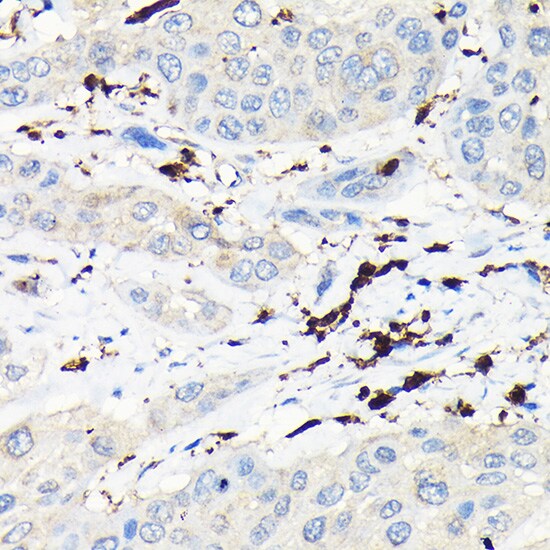 Coronin-1a Antibody