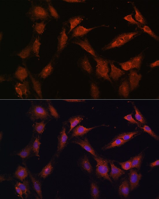PFKFB2 Antibody