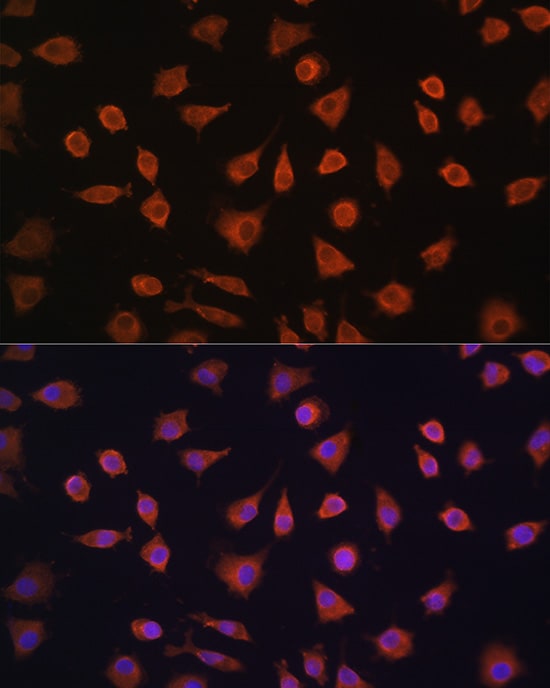 PFKFB2 Antibody
