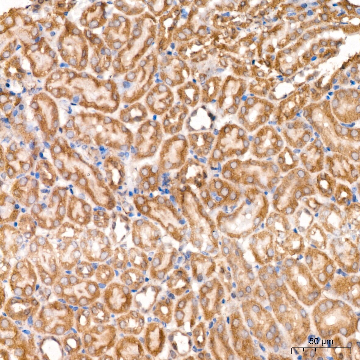 PCCA Antibody
