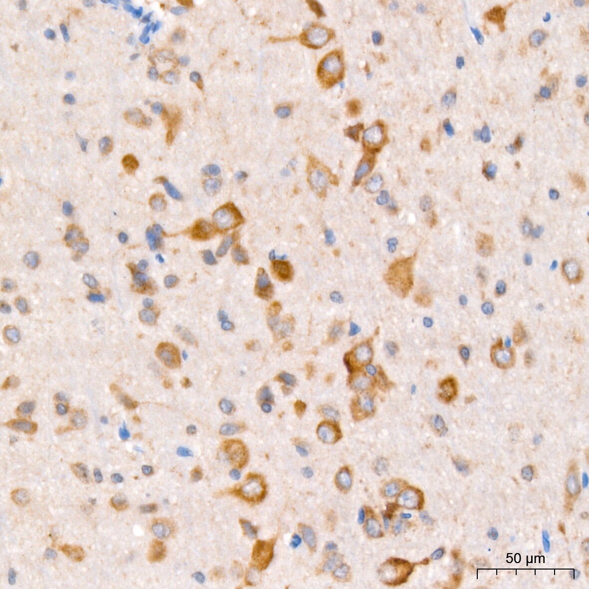 PCCA Antibody