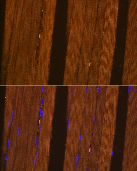 FBP2 Antibody