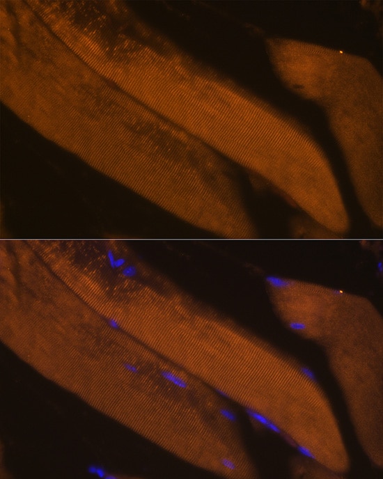 FBP2 Antibody