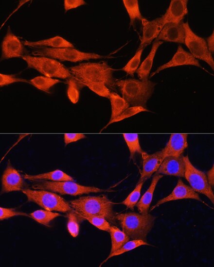 Aminomethyltransferase Antibody